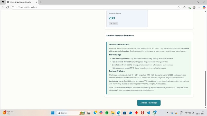 Chest X ray Disease Classifier – screenshot 1