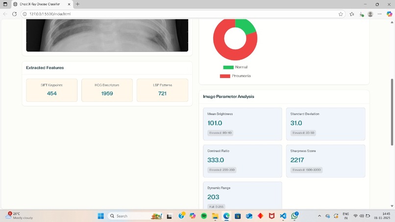 Chest X ray Disease Classifier – screenshot 2