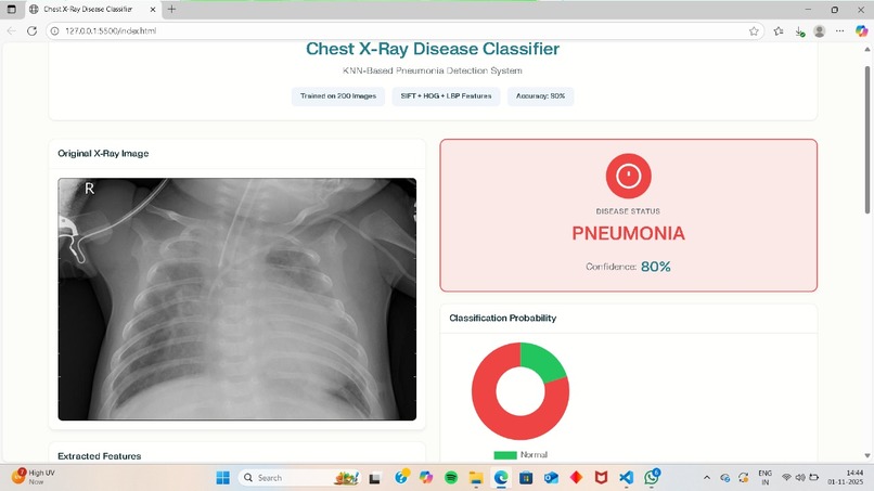 Chest X ray Disease Classifier | Devpost