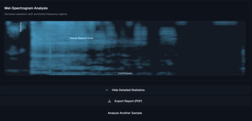 ParkinSense – screenshot 4