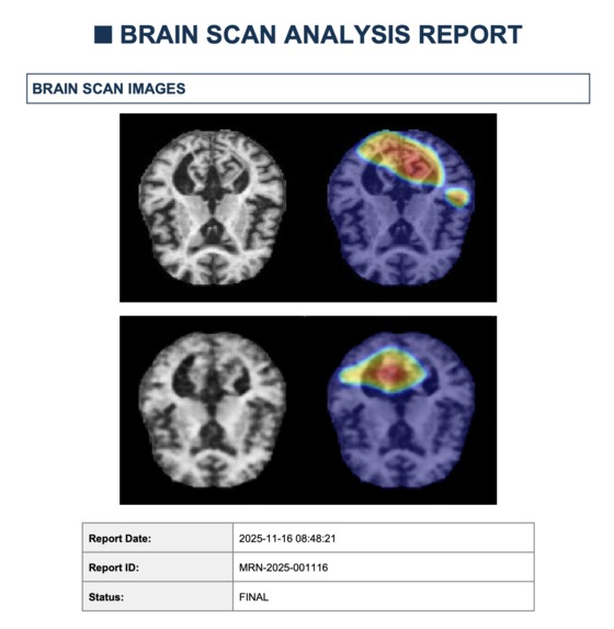 RetroBrainScan – screenshot 4