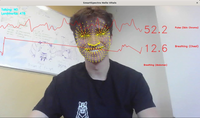 PulseAI – screenshot 1