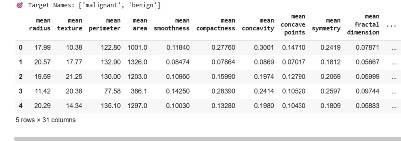  AI-Based Breast Cancer Detection System – screenshot 4
