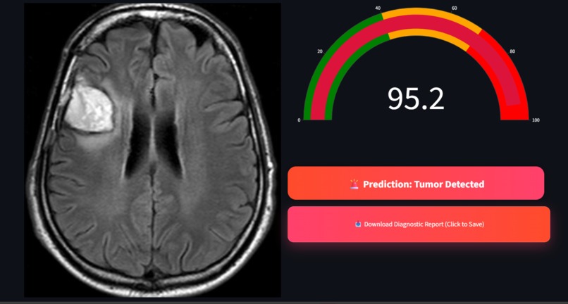 NeuroScan AI – screenshot 5
