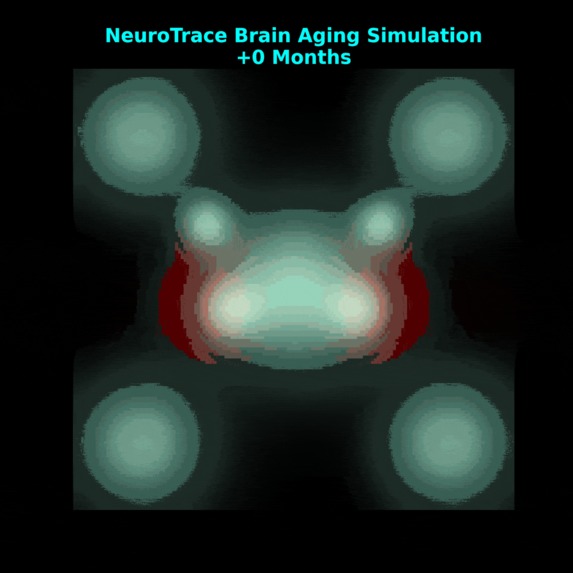 NeuroTrace – Real-Time Alzheimer’s Brain Aging Forecaster – screenshot 2