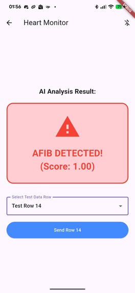 Ai-Based-Afib-Detection – screenshot 1