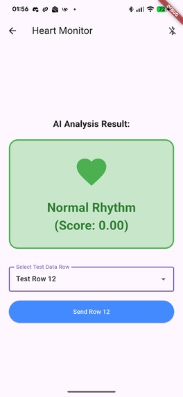 Ai-Based-Afib-Detection – screenshot 2