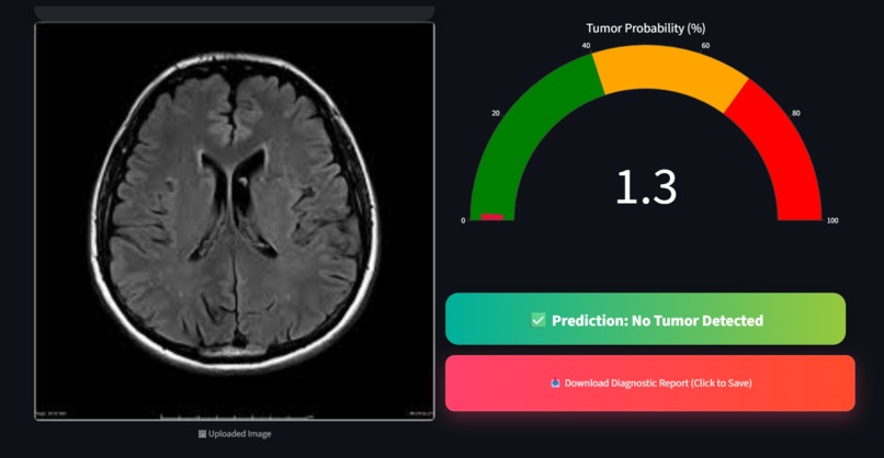 NeuroScan AI – screenshot 6
