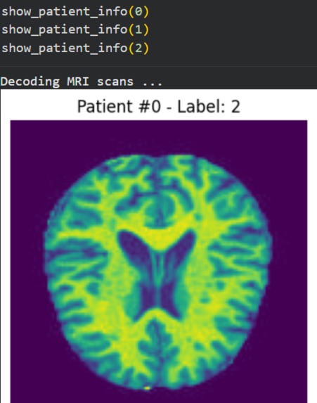 Alzymers – screenshot 2