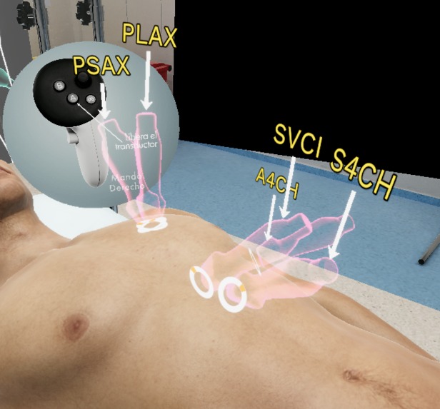 VR Echocardiography Training – screenshot 5