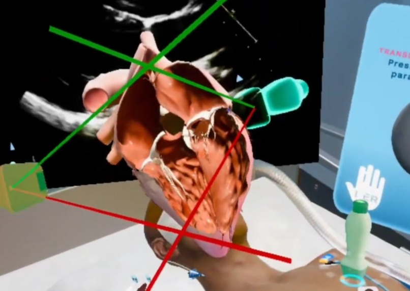 VR Echocardiography Training – screenshot 7
