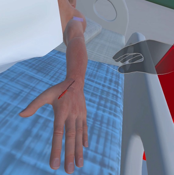 XI-Surg – screenshot 4