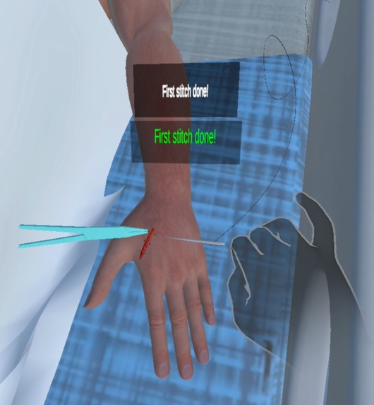 XI-Surg – screenshot 5