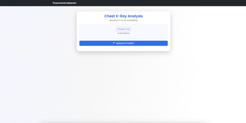 Pneumonia X-Ray Detector – screenshot 2
