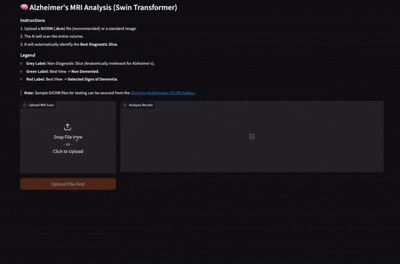 Alzheimer's Detection from MRI Scans – screenshot 1