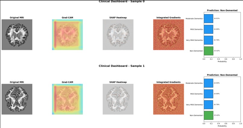 NeuroXAI: Advanced Explainable Alzheimer's Detection System – screenshot 1