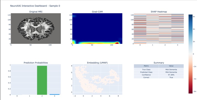NeuroXAI: Advanced Explainable Alzheimer's Detection System – screenshot 2