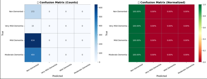 NeuroXAI: Advanced Explainable Alzheimer's Detection System – screenshot 5