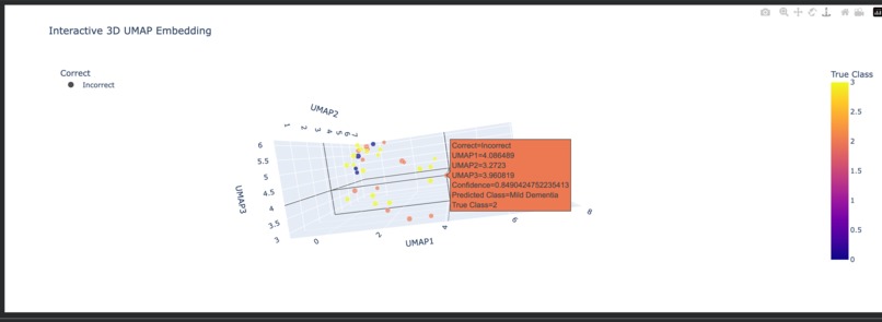 NeuroXAI: Advanced Explainable Alzheimer's Detection System – screenshot 14