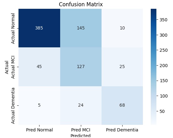 Multimodal AI for Early Detection of Alzheimer’s Disease – screenshot 3