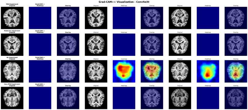 NeuroScanAI – screenshot 2