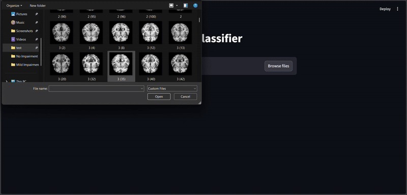AI for Alzheimer's MRI – screenshot 1