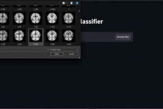 AI for Alzheimer's MRI