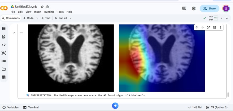 GenoVision-AD – screenshot 3