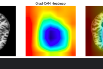 Explainable Alzheimer’s Detection from MRI Using ResNet