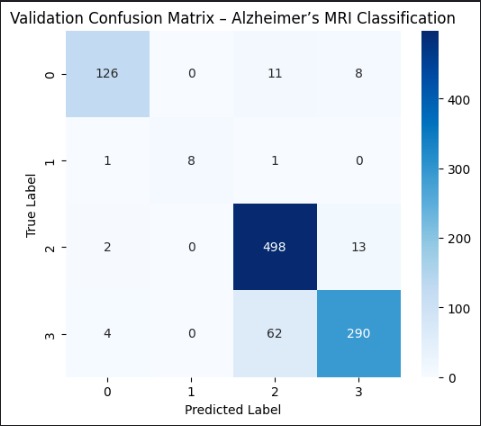 Explainable Alzheimer’s Detection from MRI Using ResNet – screenshot 2
