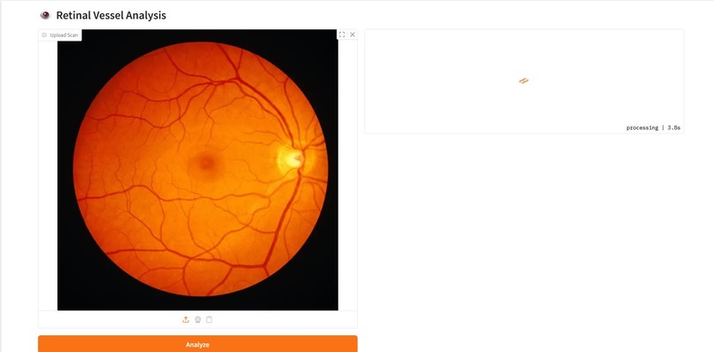 Retina-Vessel-AI-Analyzer – screenshot 2