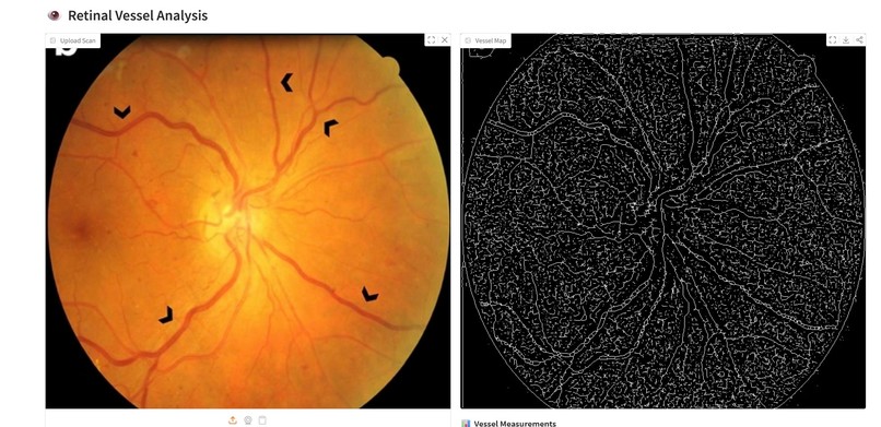 Retina-Vessel-AI-Analyzer – screenshot 3