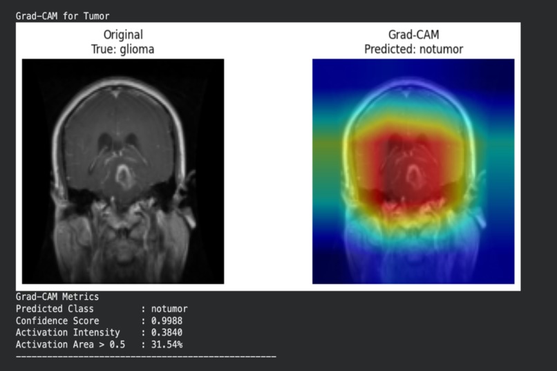 SSL for Alzheimers – screenshot 5