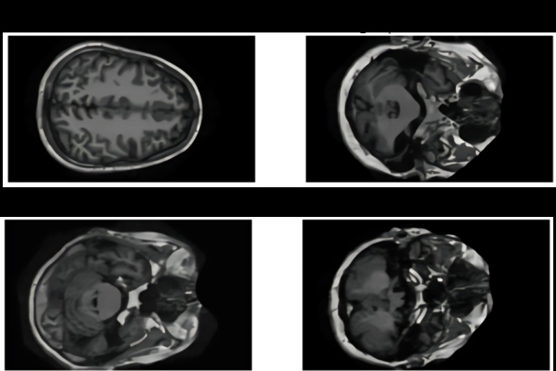 SSL for Alzheimers – screenshot 4