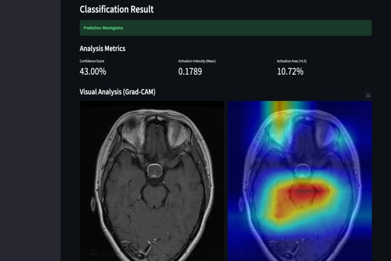 SSL for Alzheimers – screenshot 8
