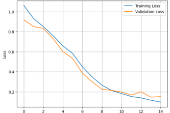 AI‑Based Alzheimer’s Detection Using MRI Brain Scans