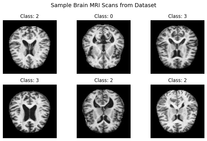 AI‑Based Alzheimer’s Detection Using MRI Brain Scans – screenshot 3