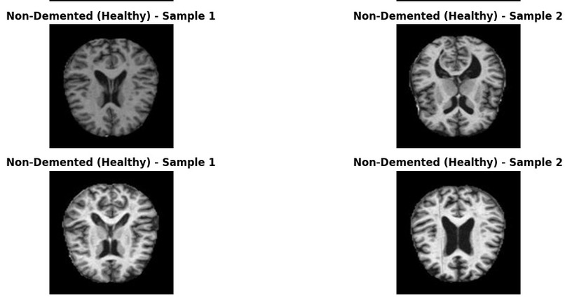 BrainGuard – screenshot 5