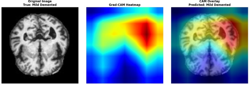 BrainGuard – screenshot 6