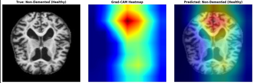 BrainGuard – screenshot 7