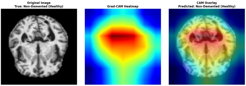 BrainGuard – screenshot 8