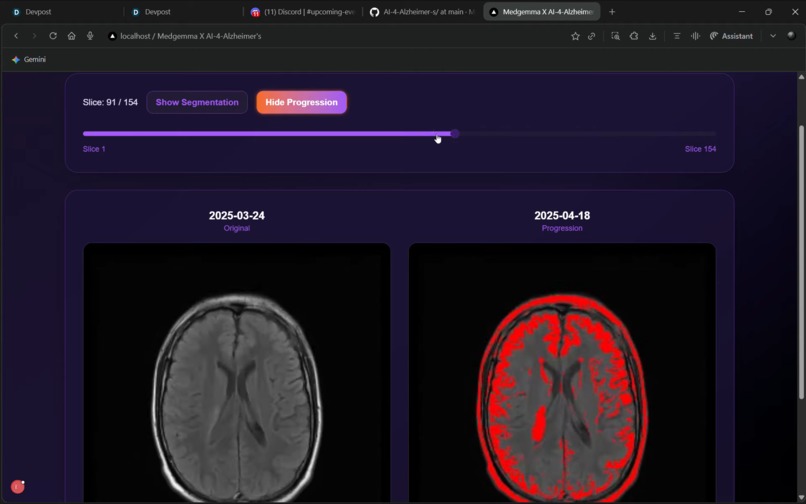 Medgemma X AI-4-Alzheimer-s – screenshot 11
