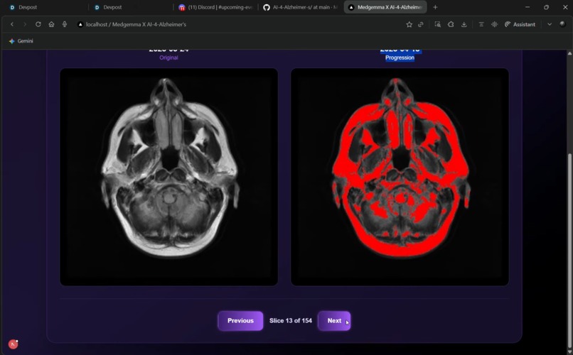 Medgemma X AI-4-Alzheimer-s – screenshot 12