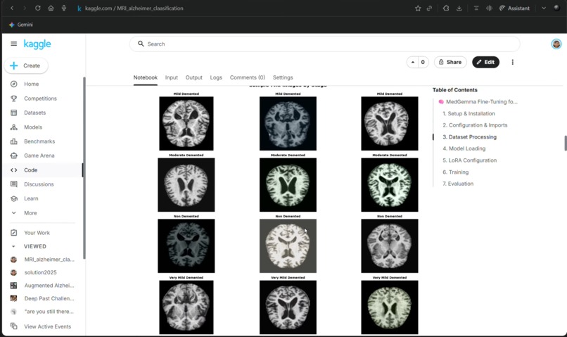 Medgemma X AI-4-Alzheimer-s – screenshot 13