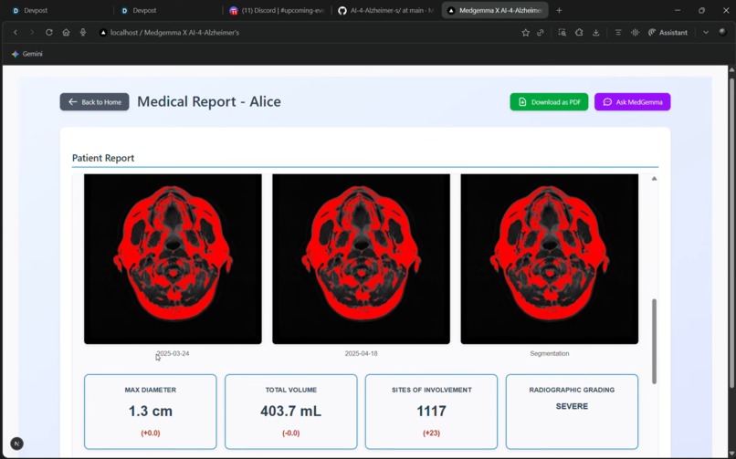 Medgemma X AI-4-Alzheimer-s – screenshot 14