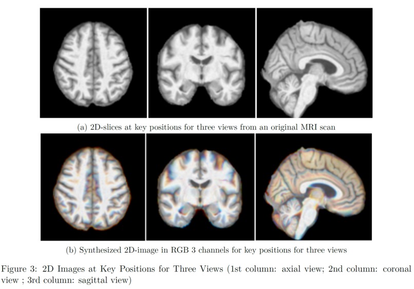 AD_Prediction – screenshot 4