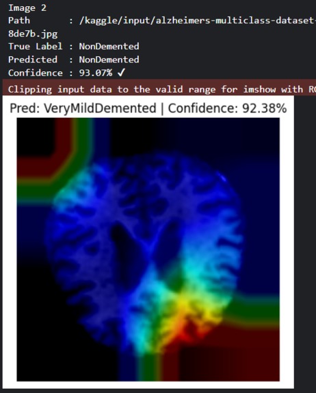 Gaurdians Intercept Dimentia & Alzheimers – screenshot 4