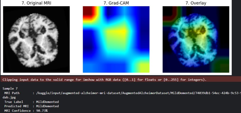 Gaurdians Intercept Dimentia & Alzheimers – screenshot 5