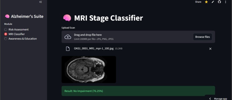 NeuroLens - Alzheimer's detection system – screenshot 4