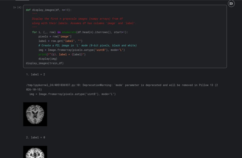 Detecting Alzheimer's with CNNs – screenshot 2